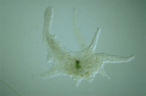 Naked Amoeba: Unearthing the Fascinating Microscopic World of a Single-Celled Creature!