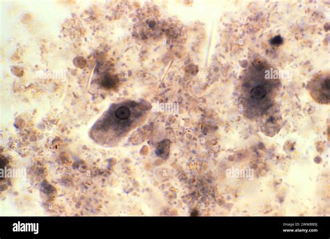  Siderocystis! Can This Amoeboid Master Of Iron Steal Your Heart?